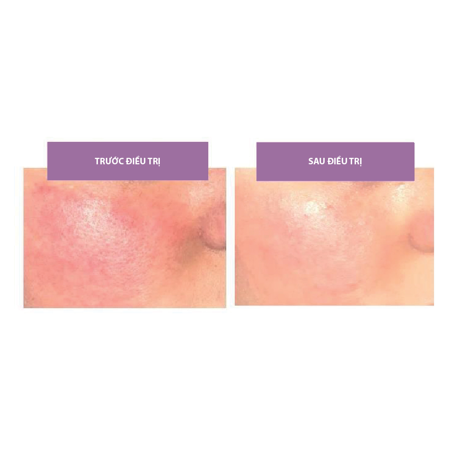 mdcocktail Rosalac Sens Neutralizer - oscar-medical 3